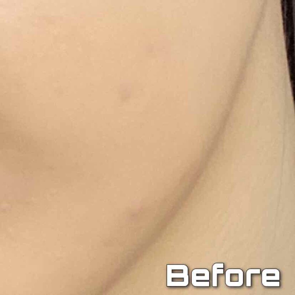 レッドコンシーラー/MEDICUBE/リキッドコンシーラーを使ったクチコミ(2枚目)