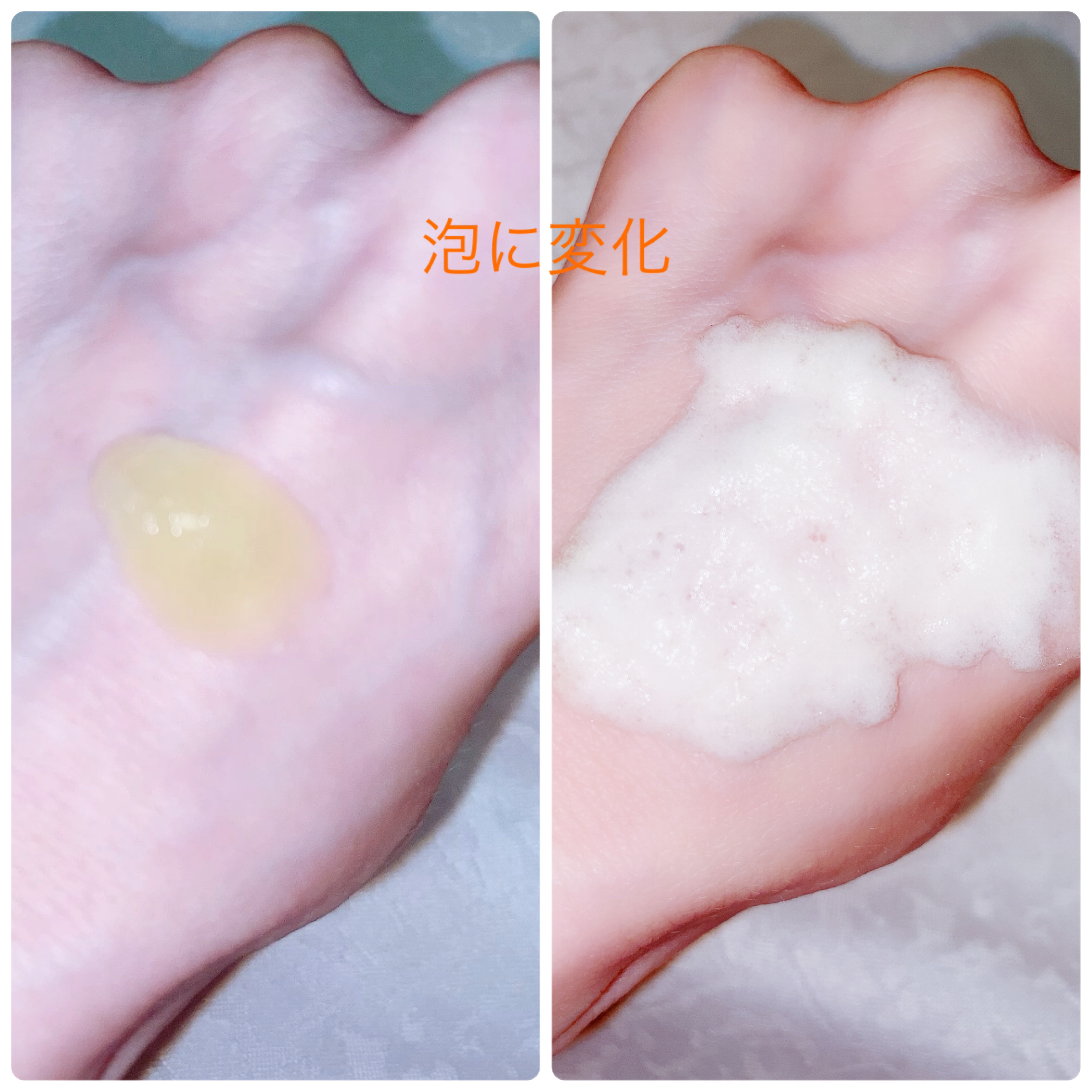 クレンジングジェルGF/F&W/泡洗顔を使ったクチコミ（3枚目）