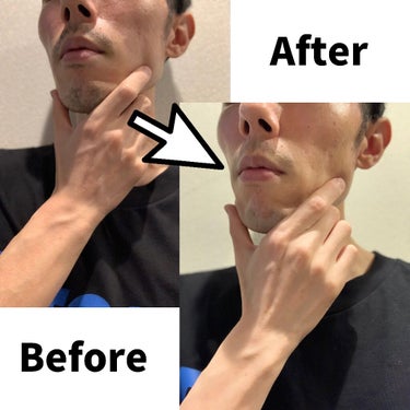 シック Schick 極 KIWAMI ホルダー 敏感肌用|シックの口コミ - \敏感