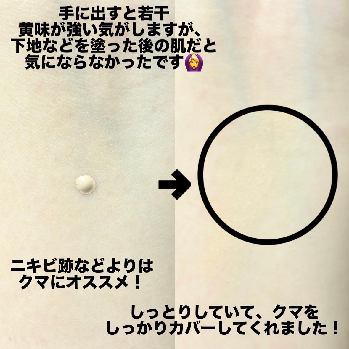 スタジオ ラディアンス 24 ルミナス コンシーラー/M・A・C/リキッドコンシーラーを使ったクチコミ(3枚目)