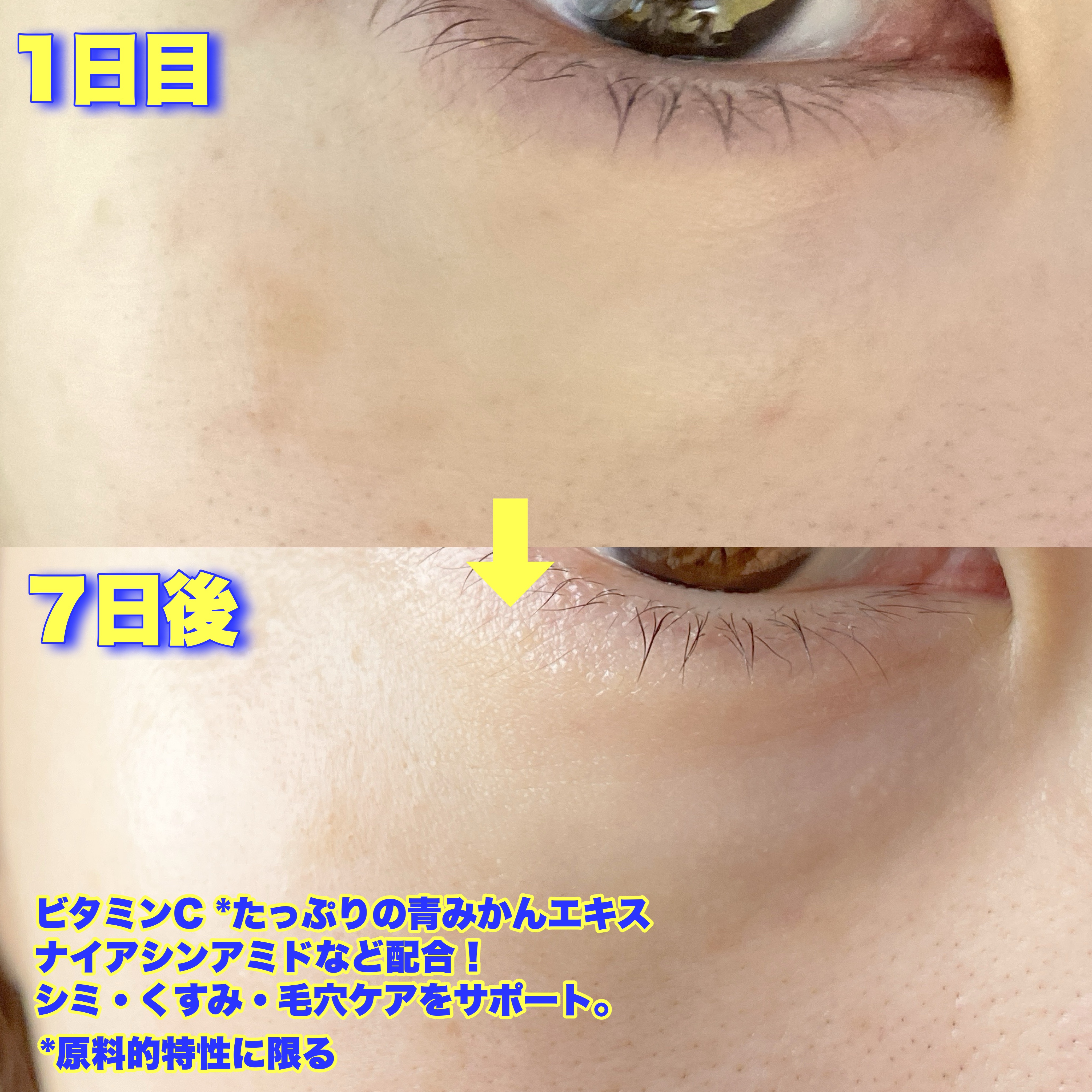 グリーンタンジェリンビタC27ダークスポットケアアンプル/goodal/美容液を使ったクチコミ（3枚目）