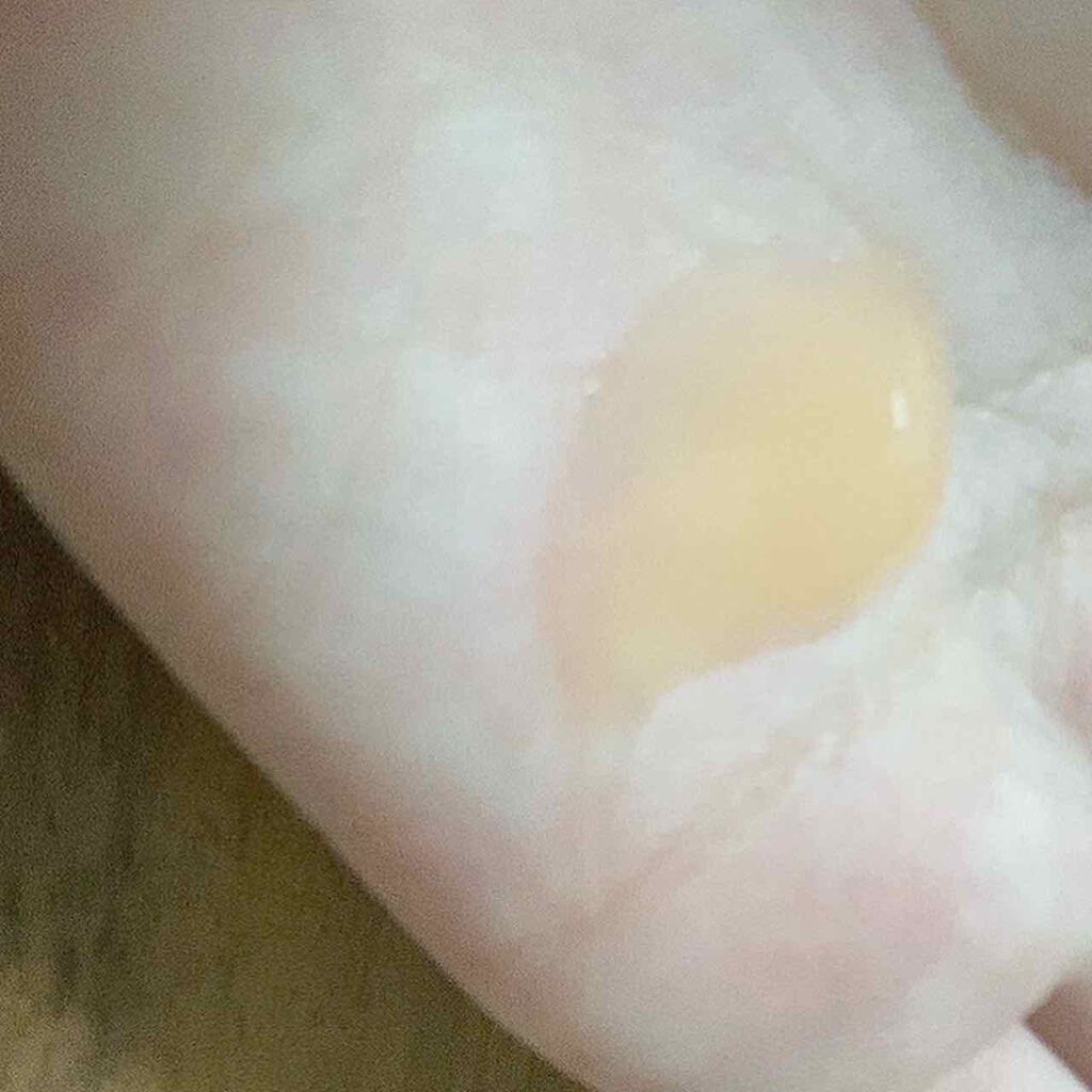 マインパーフェクトゲル<オールインワン美容液>/mign/オールインワン化粧品を使ったクチコミ(2枚目)