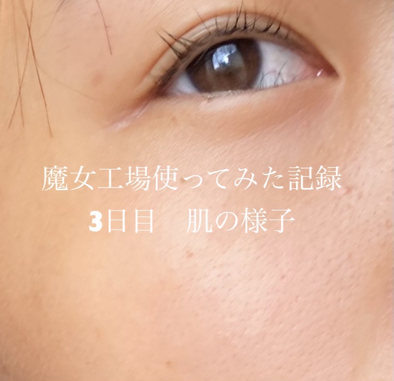 初めて魔女工場を
ライン使いする事に、

最近疲れが肌に出るようになっていて
毛穴開きと赤みが…。


早速使ってみました


朝起きて洗顔する前に
ふと顔を見たらなんだか
ツヤツヤでびっくりした印象です🐘


変化あれば更新します


