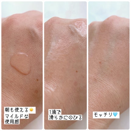 RXザ・ナイアシンアミド15セラム  /COSRX/美容液を使ったクチコミ(2枚目)