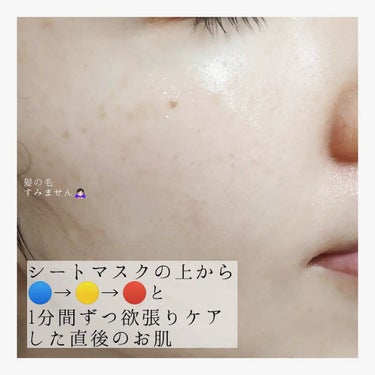 スキンライトセラピーII/Makeon/美顔器・マッサージを使ったクチコミ（8枚目）