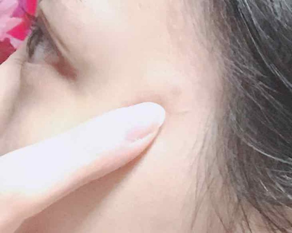 A-zero Shot Trouble Dressing Spot Patch/MEDIHEAL/シートマスク・パックを使ったクチコミ（3枚目）