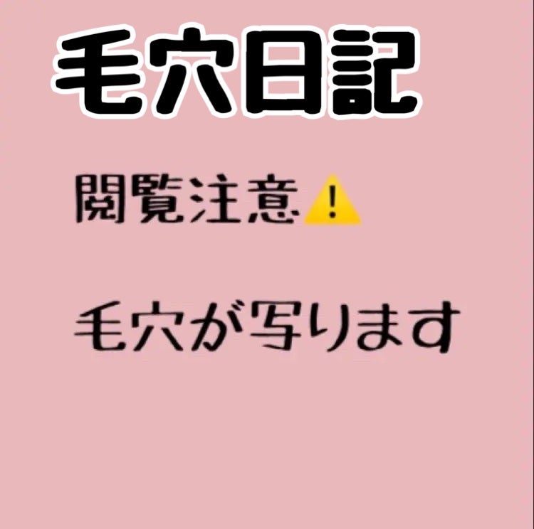 YORIAI☕️ on LIPS 「毛穴日記Part1この毛穴とキメの粗さヤバくないですか😭最近サ..」(1枚目)