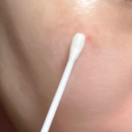 マジックティーツリーオイル/ブラン/フェイスオイルを使ったクチコミ(3枚目)