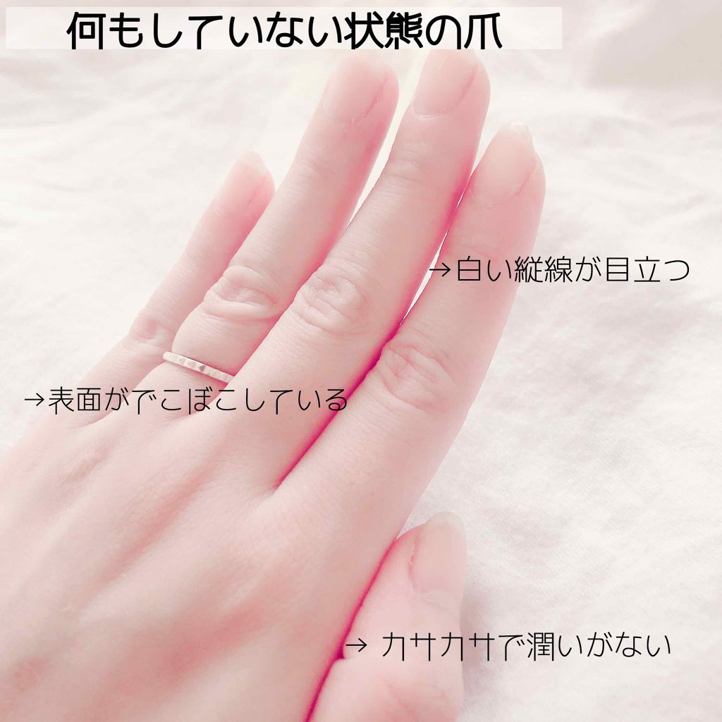 ディーアップファンデーション/D-UP/ネイルベースコートを使ったクチコミ(2枚目)