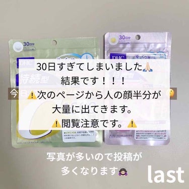 ラストです！

ここで急に出てきたメディヒールとはとむぎ🤭


🐰メディヒールについて🏹

気持ちの問題だと思いますが、日本製の物の方が綺麗になった気がします🤔
使った後は、え、綺麗！？とびっくりしまし