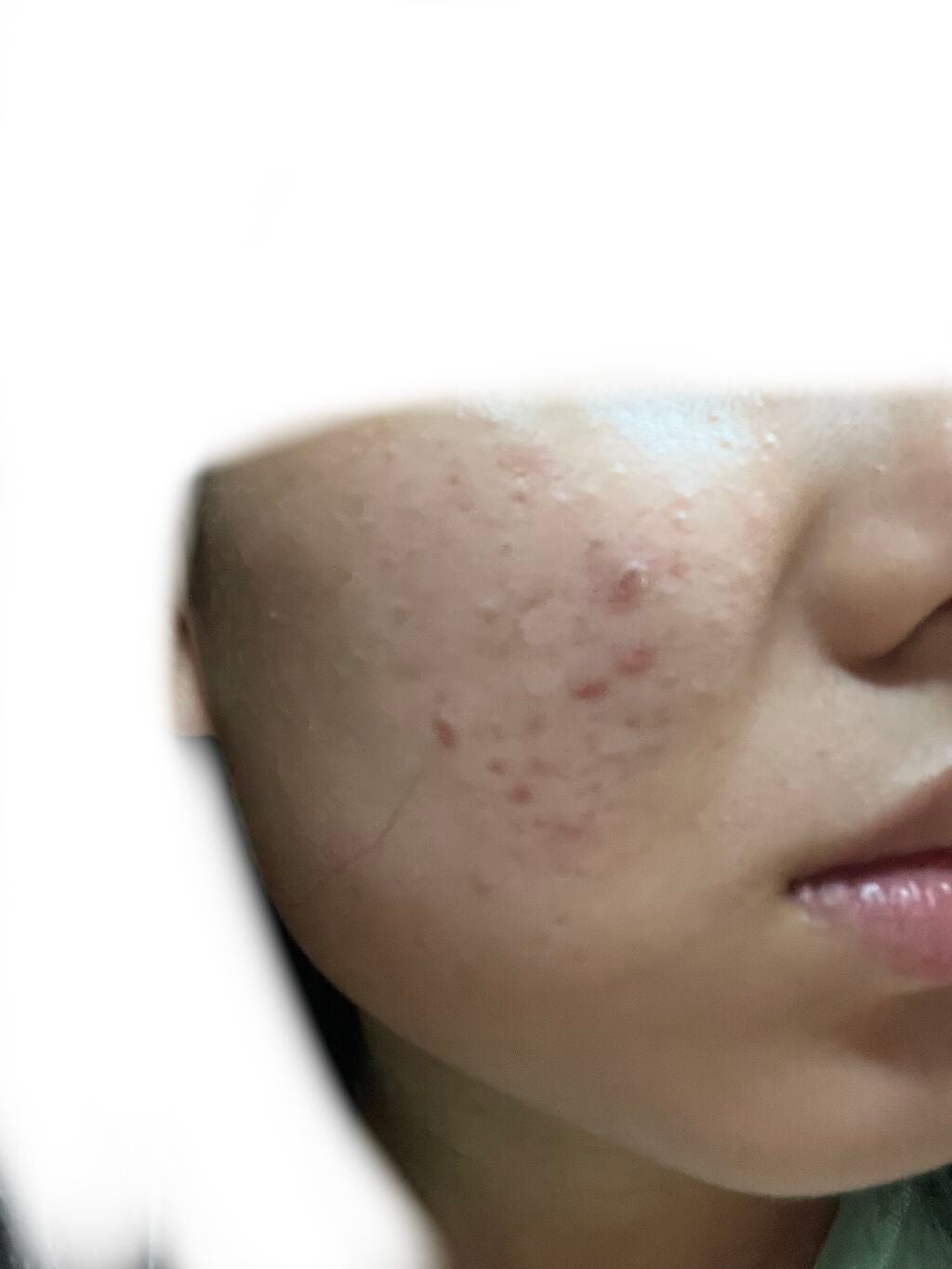 きめこんぴ on LIPS 「初めまして!きめこんぴと申します。単刀直入に言うと、助けてくだ..」(3枚目)