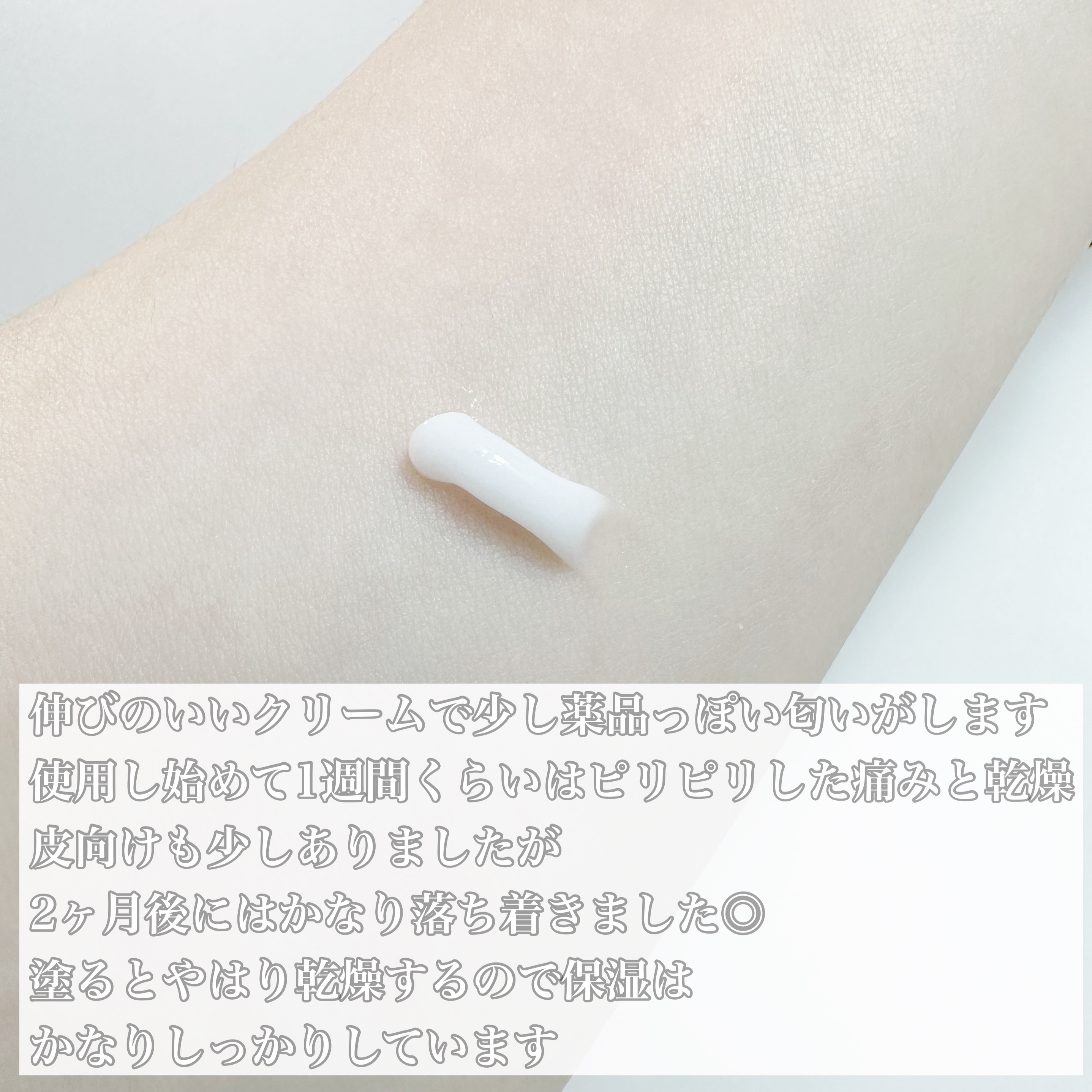 STUBBORN ACNE AM TREATMENT/Neutrogena/その他を使ったクチコミ（3枚目）