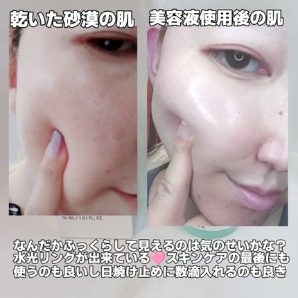 PDRNヒアルロン酸カプセル100セラム/Anua/美容液を使ったクチコミ(7枚目)