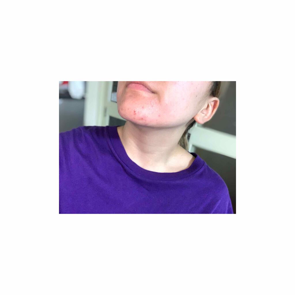 化粧水・敏感肌用・高保湿タイプ/無印良品/化粧水を使ったクチコミ(2枚目)