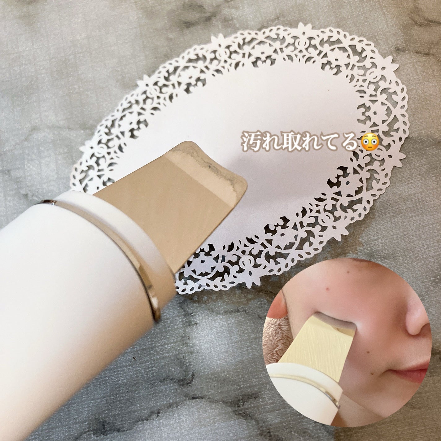 ウォーターピーリング/ANLAN/美顔器・マッサージを使ったクチコミ(3枚目)