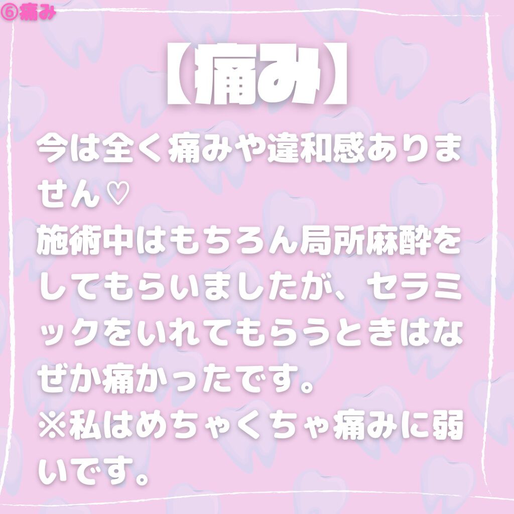 コンクールF/ウエルテック/マウスウォッシュ・スプレーを使ったクチコミ(8枚目)
