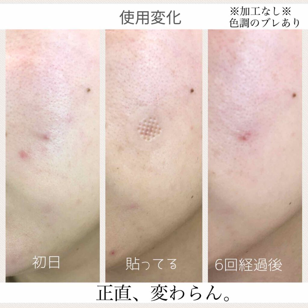 素肌美人VITA/ACROPASS/シートマスク・パックを使ったクチコミ(4枚目)