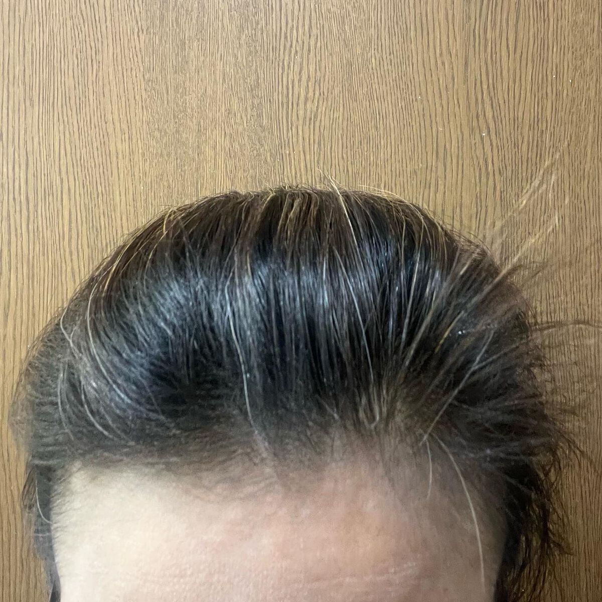 ウォーターレス ドライシャンプー/エイトザタラソ/ドライシャンプーを使ったクチコミ（3枚目）