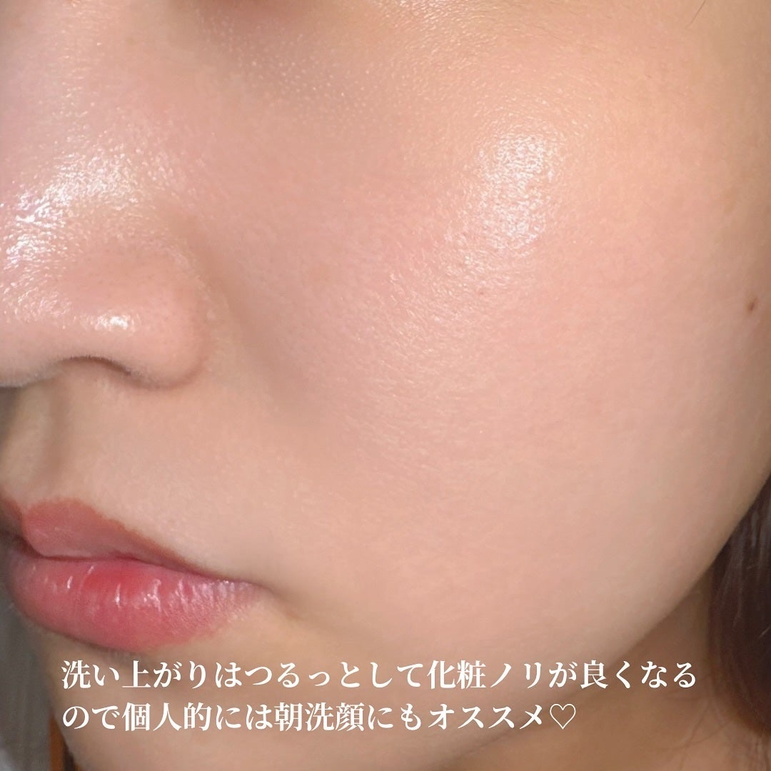 W酵素洗顔フォーム/SHIMBI METHOD/泡洗顔を使ったクチコミ(5枚目)