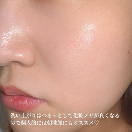 W酵素洗顔フォーム/SHIMBI METHOD/泡洗顔を使ったクチコミ(5枚目)