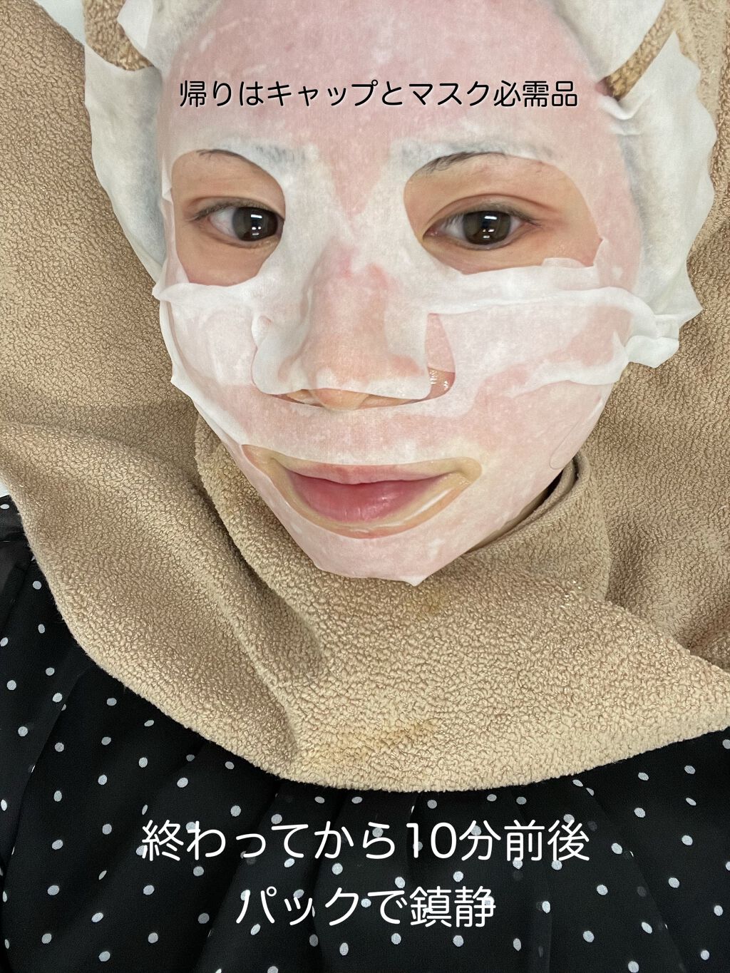 あゆみんっ。 on LIPS 「最近何かと話題な美容医療施術【ダーマペン4】当日終わってまで編..」(3枚目)