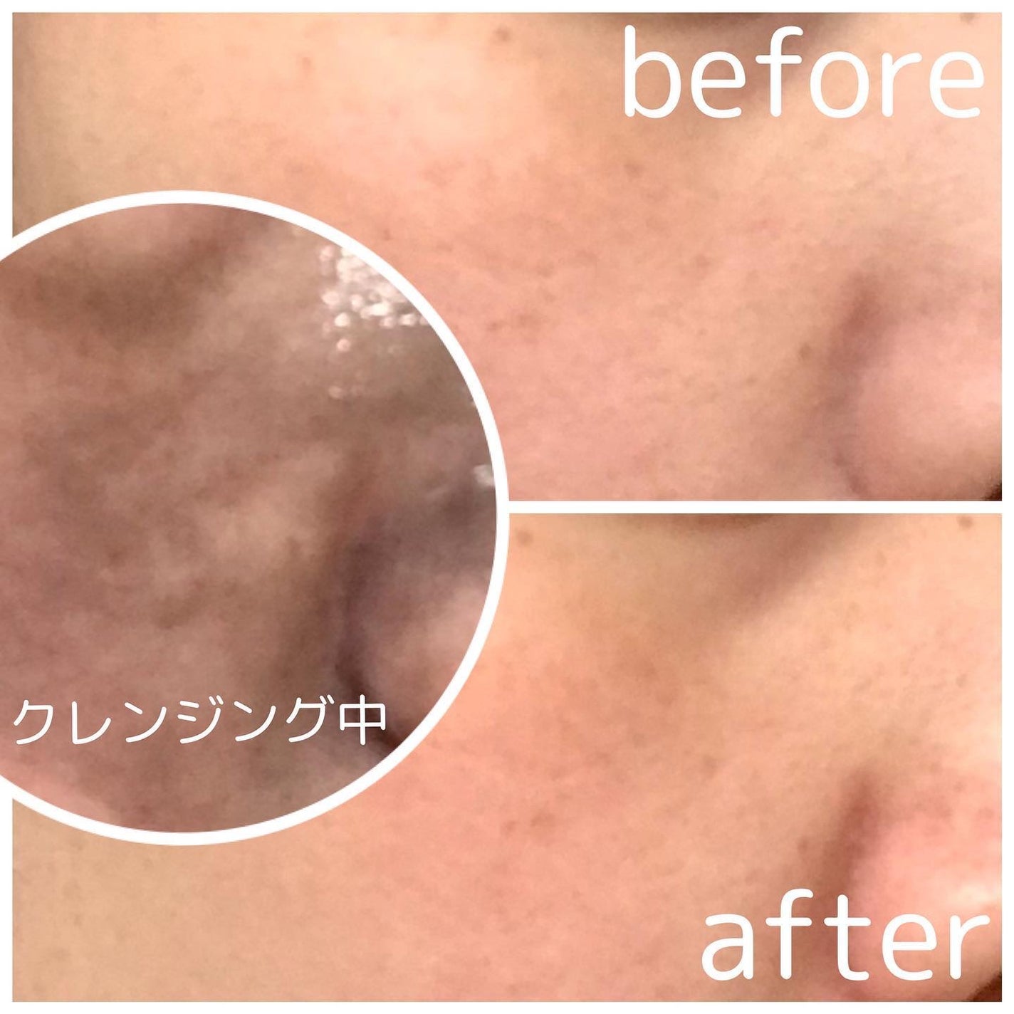 ブラックジェルクレンジング/.akaran/クレンジングジェルを使ったクチコミ(5枚目)