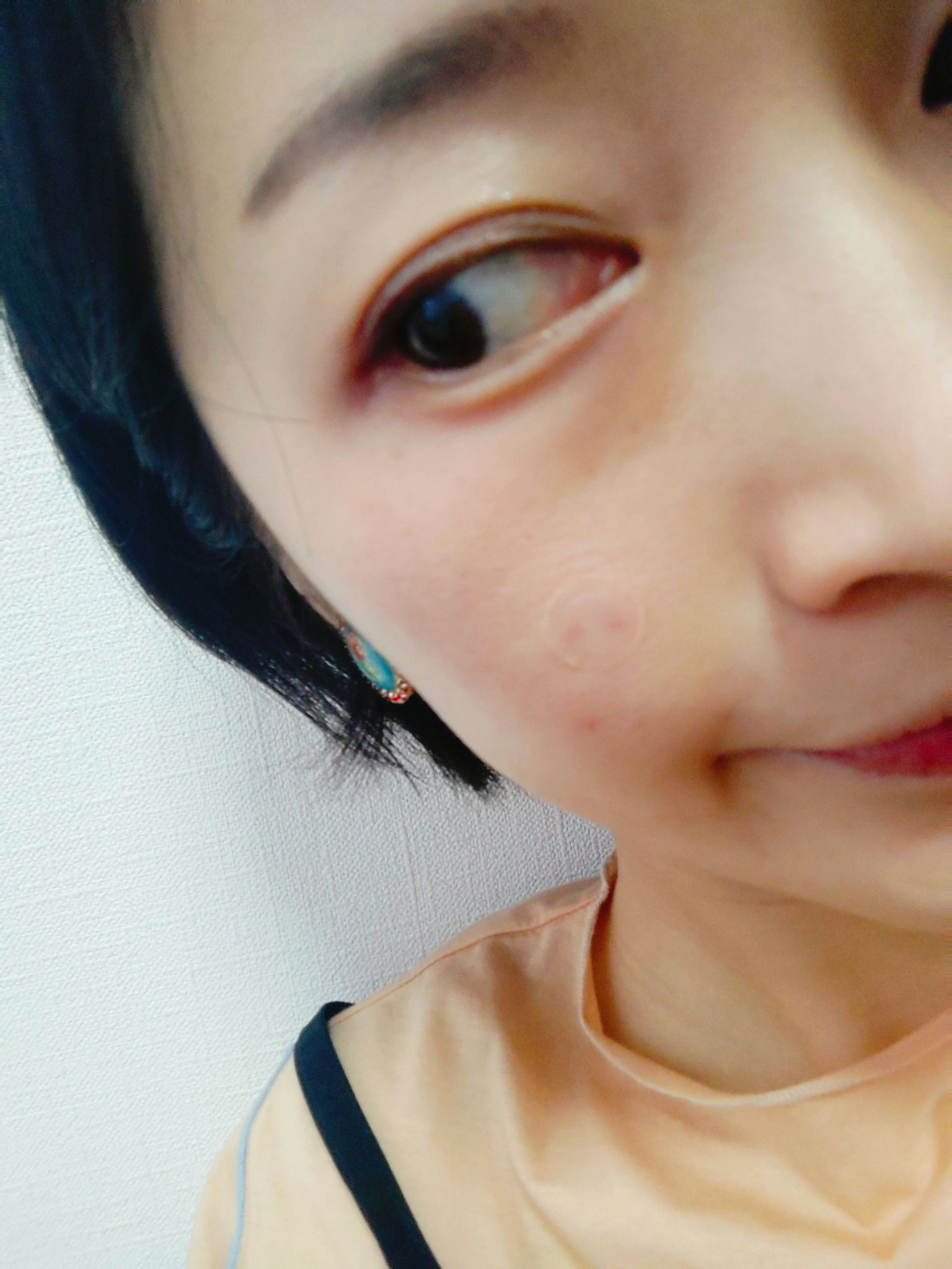 ゼロスポットパッチCICA/Today’s Cosme/その他スキンケアを使ったクチコミ（2枚目）