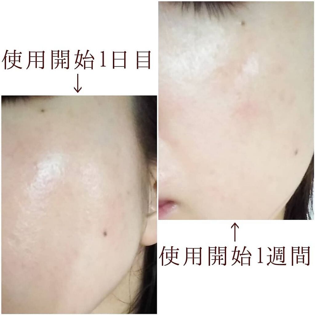 ポリシー パウダーエッセンス CO/ポリシー化粧品/美容液を使ったクチコミ(3枚目)