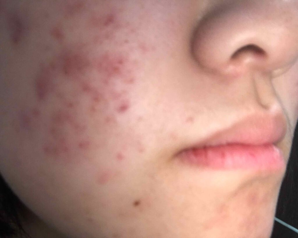 クリアケア化粧水 高保湿タイプ/無印良品/化粧水を使ったクチコミ（2枚目）