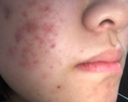 明色美顔水 薬用化粧水/美顔/化粧水を使ったクチコミ(2枚目)