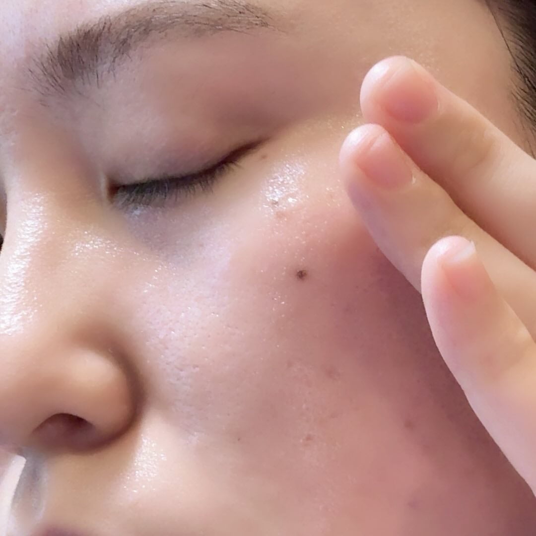 セラムヴェール ディープリペア/ONE BY KOSE/美容液を使ったクチコミ(7枚目)