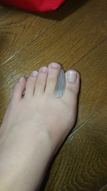 外反母趾保護パッド ドクター ショールの口コミ こんばんは ついに 恐れてた 外反母趾 By 美葵 普通肌 代前半 Lips