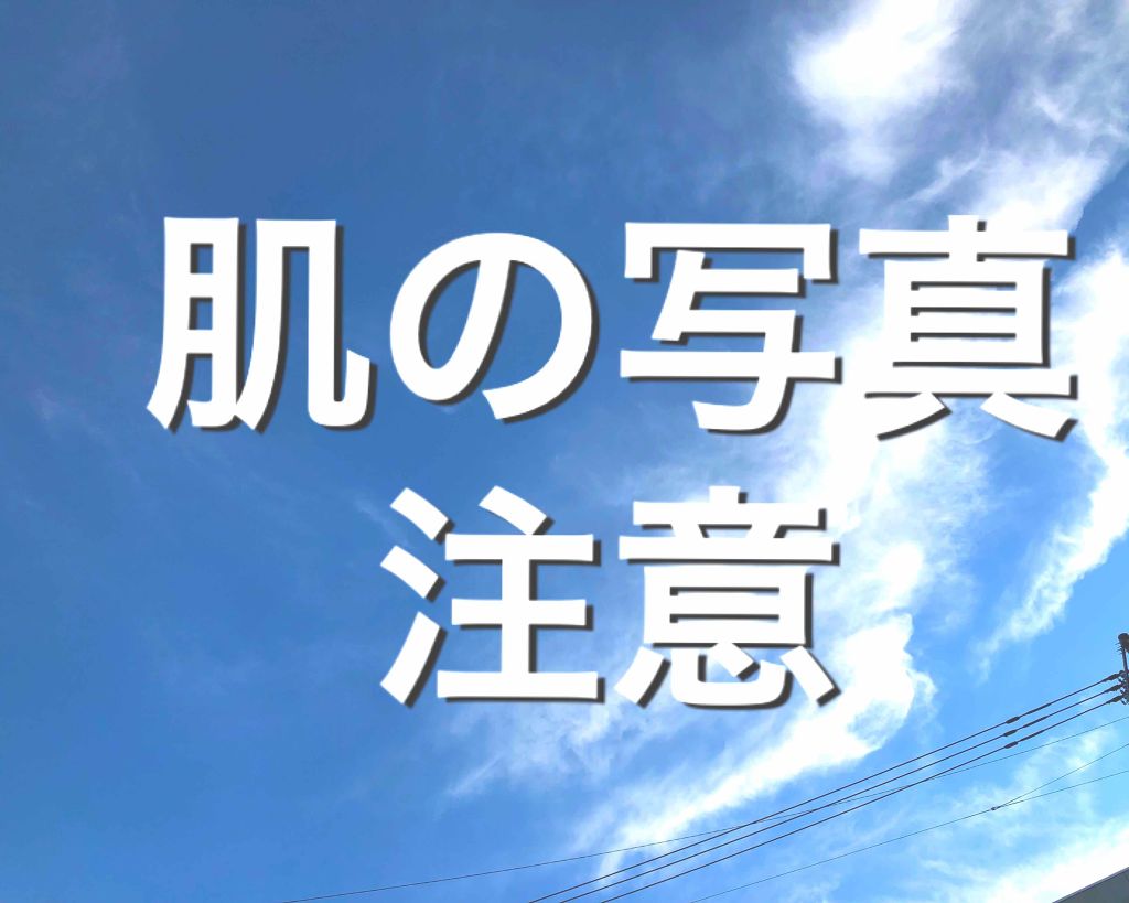 ACC パッチ/ETUDE/シートマスク・パックを使ったクチコミ(1枚目)