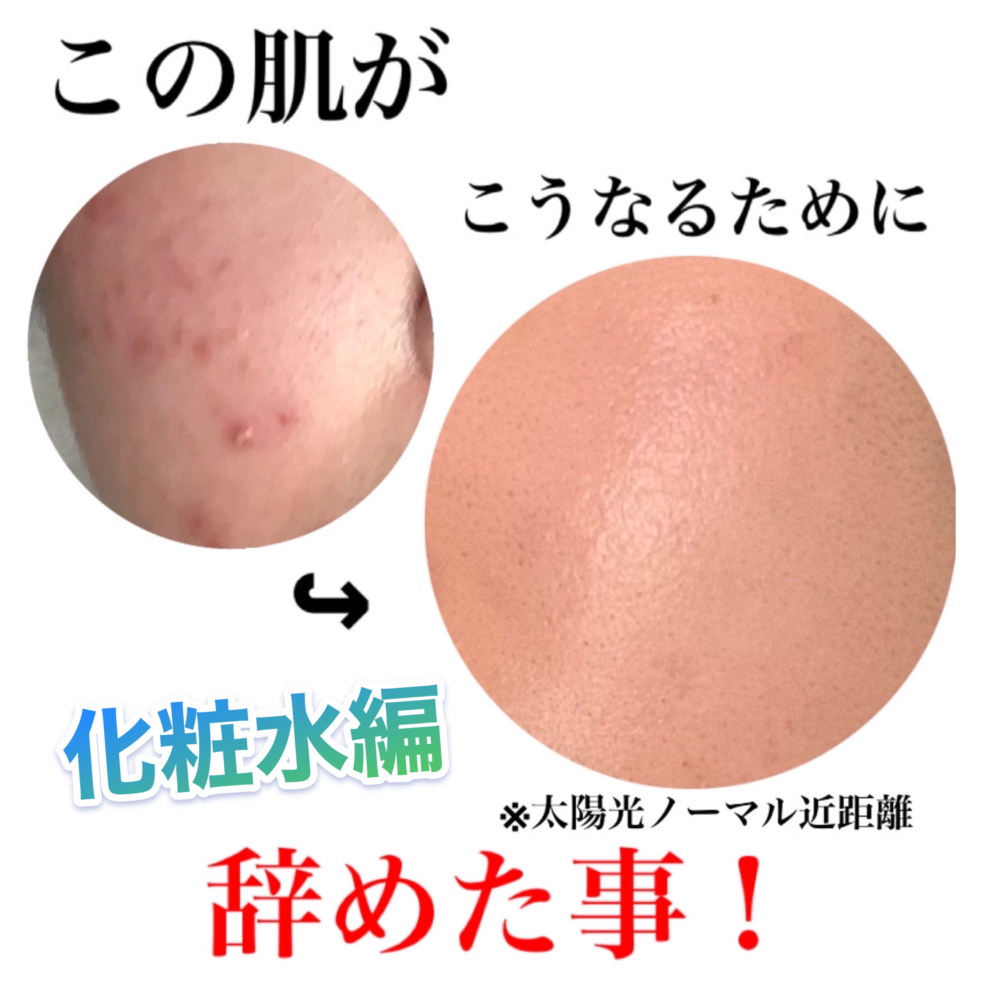 皮脂トラブルケア 化粧水/キュレル/化粧水を使ったクチコミ（1枚目）