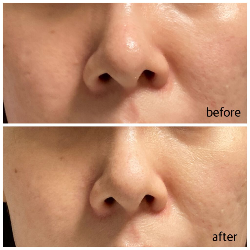 ガムシートマスク コラーゲン※10ミルク※11ステッカー/Abib /シートマスク・パックを使ったクチコミ(5枚目)