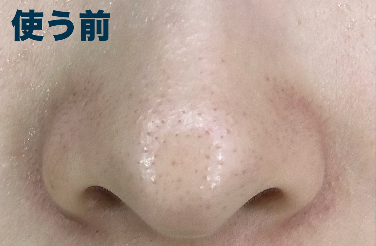 ノーズピーリングパック/One-day's you/シートマスク・パックを使ったクチコミ(2枚目)