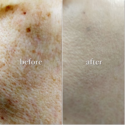 レイヤリングフィットカバークッションEX/TFIT/クッションファンデーションを使ったクチコミ(5枚目)