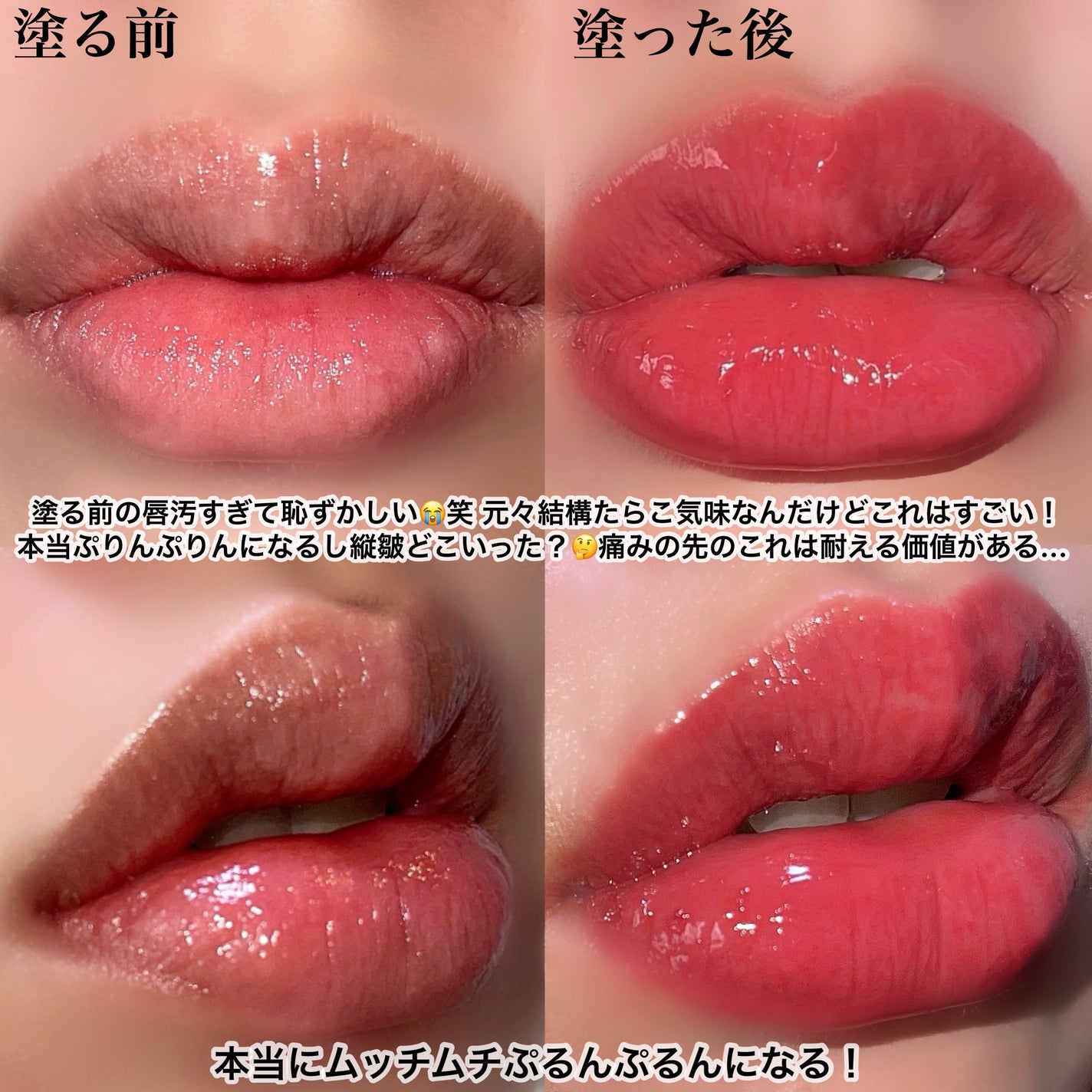 ドトムリッププラスプランパー/keybo/リッププランパーを使ったクチコミ(5枚目)