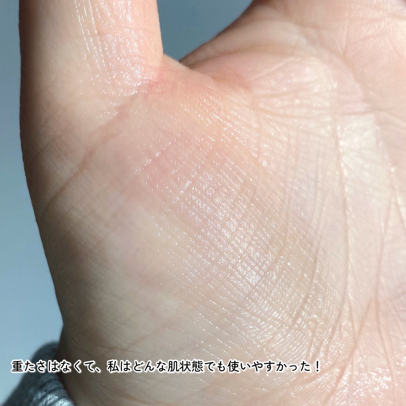 ザマデカクリーム/センテリアン24/フェイスクリームを使ったクチコミ(5枚目)