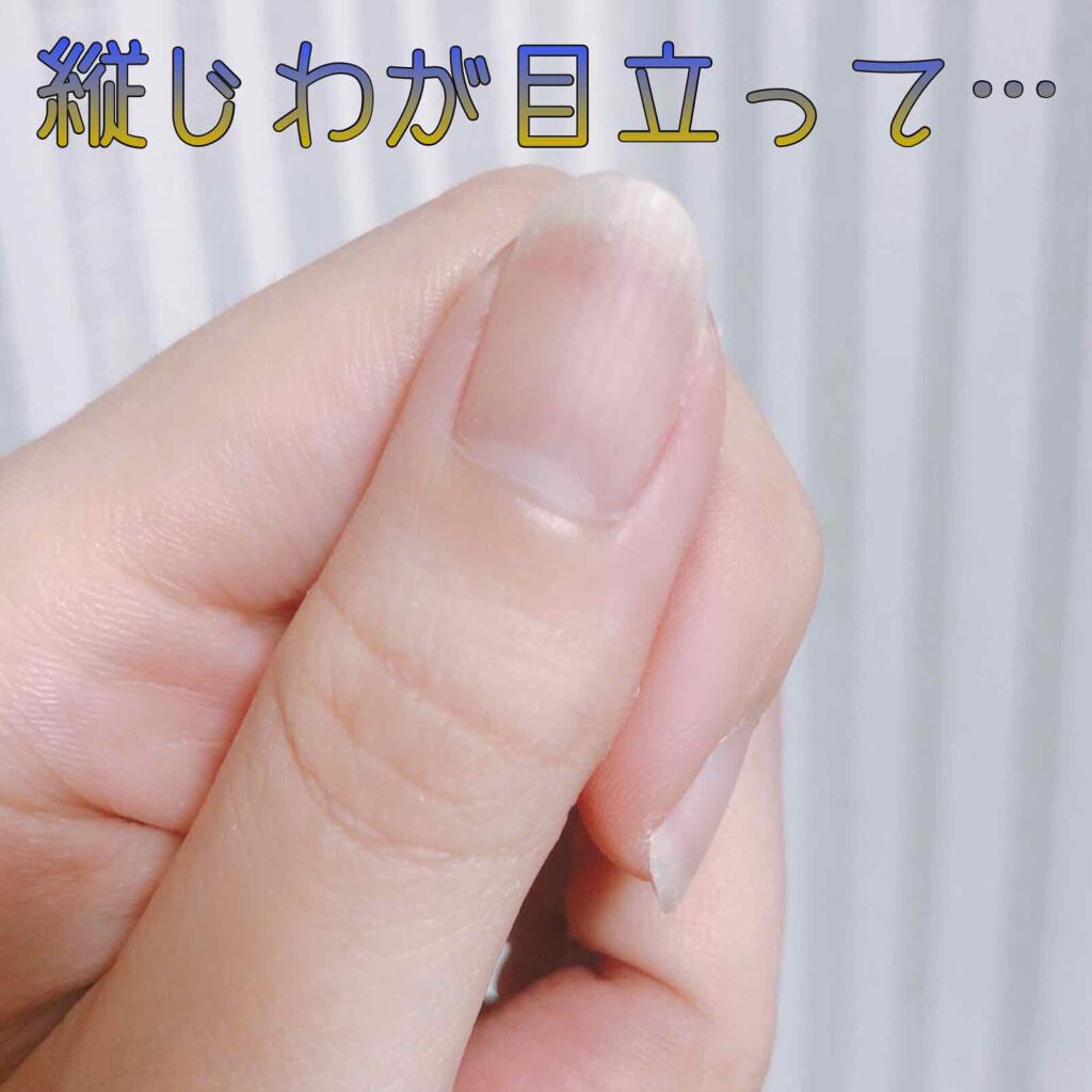 ウォータリーネイルジェル クイックグロス		/D-UP/オールインワンネイルを使ったクチコミ（1枚目）