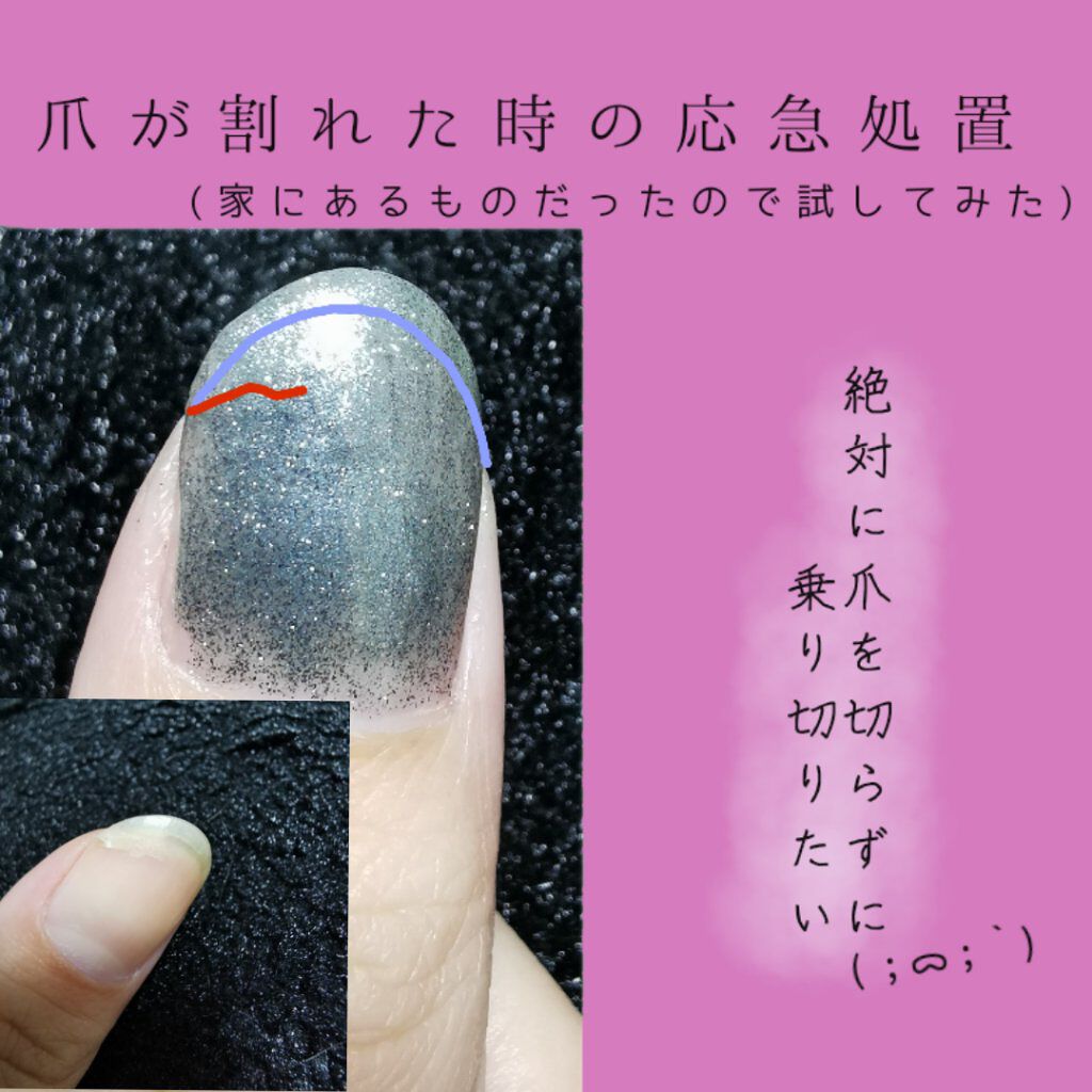 パラドゥ キャンドゥのマニキュアを使った口コミ 乾燥するといつの間にか爪がガッとひび割れを起こしてしまいます By あまざけ 乾燥肌 代前半 Lips パラドゥ キャンドゥのマニキュアを使った口コミ 乾燥するといつの間にか爪がガッとひび割れを起こしてしまいます By あまざけ 乾燥肌 代前半 Lips