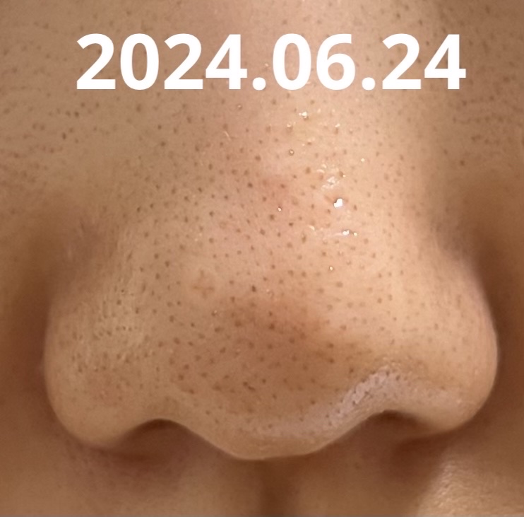 ムースネトワイアントCn/クレ・ド・ポー ボーテ/洗顔フォームを使ったクチコミ（2枚目）