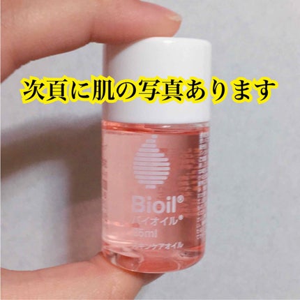 バイオイル/バイオイル/フェイスオイルを使ったクチコミ(1枚目)