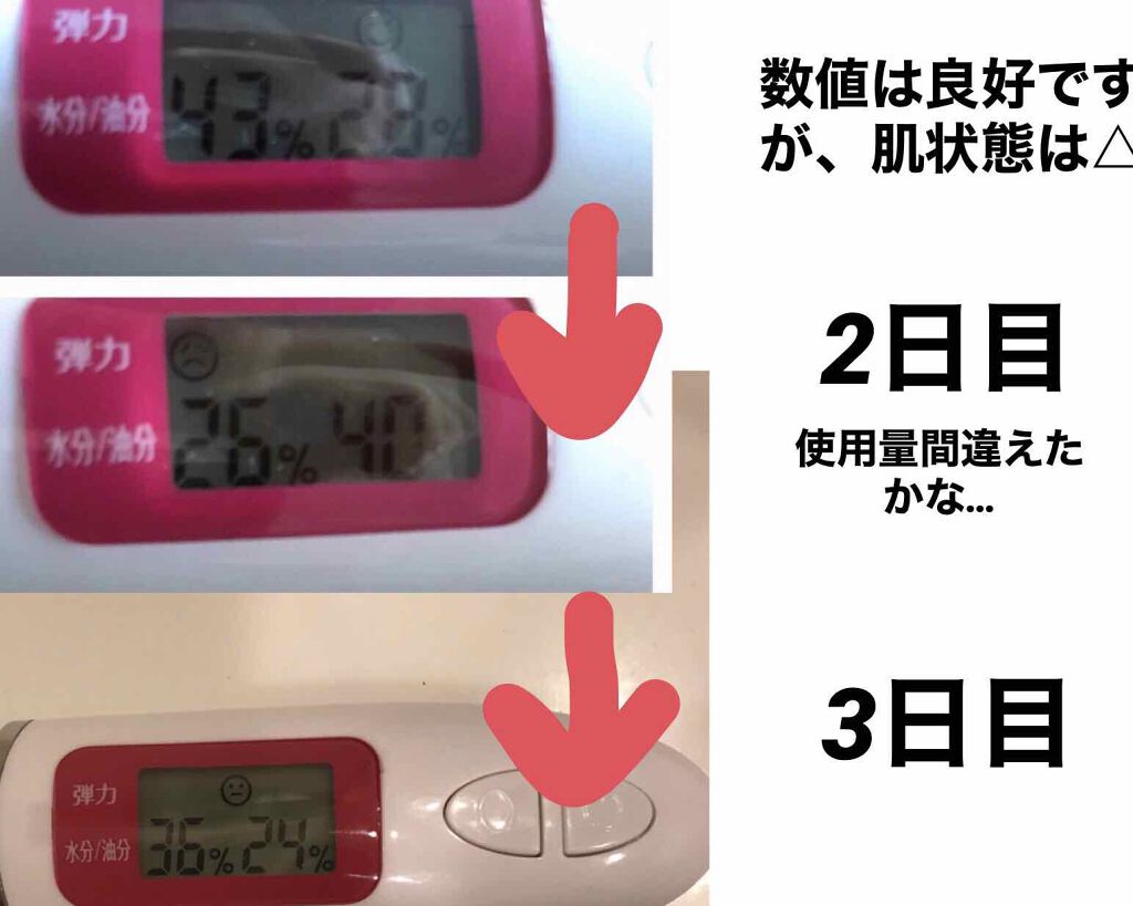 Ⅲ トライアルセット/NOV/トライアルキットを使ったクチコミ（2枚目）