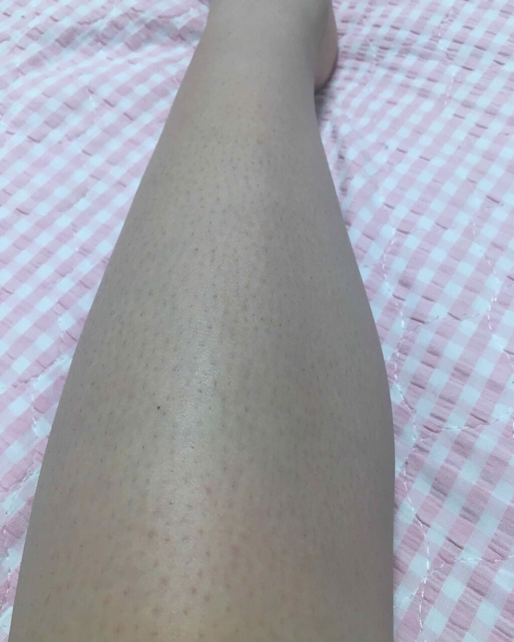 パイナップル豆乳ローション/鈴木ハーブ研究所/除毛クリームを使ったクチコミ(4枚目)