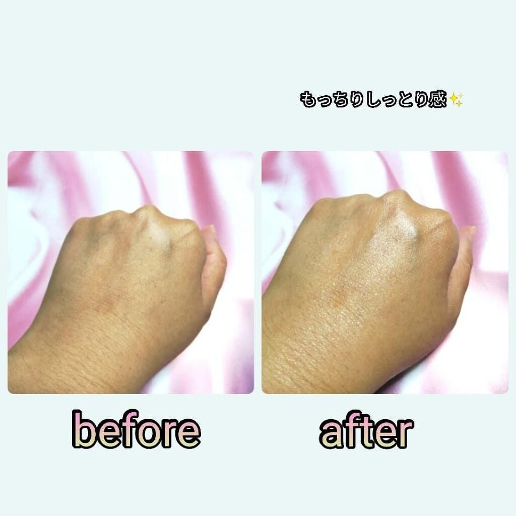 水光DMクリーム/DMクリーム/フェイスクリームを使ったクチコミ(3枚目)