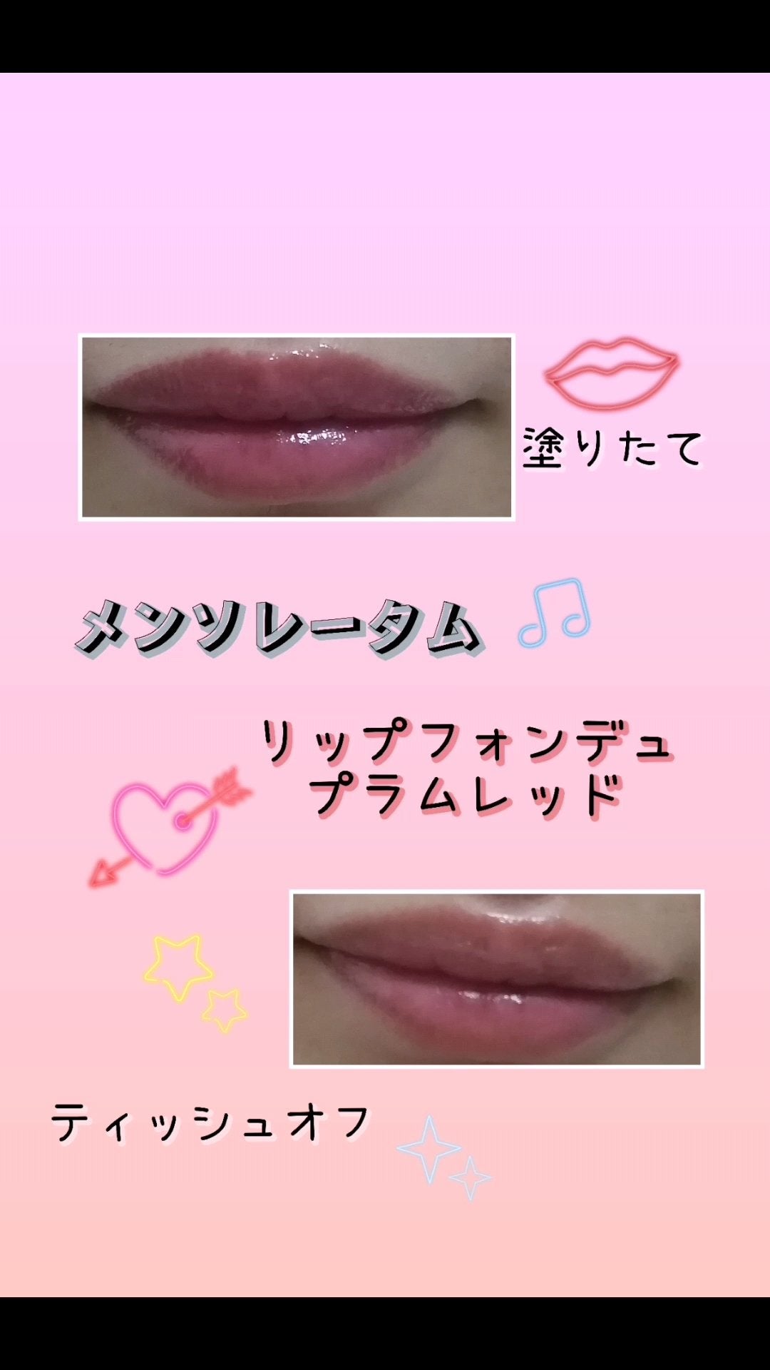 メンソレータム リップフォンデュ/メンソレータム/リッププランパーを使ったクチコミ(4枚目)