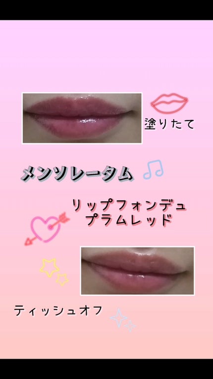 メンソレータム リップフォンデュ/メンソレータム/リッププランパーを使ったクチコミ(4枚目)