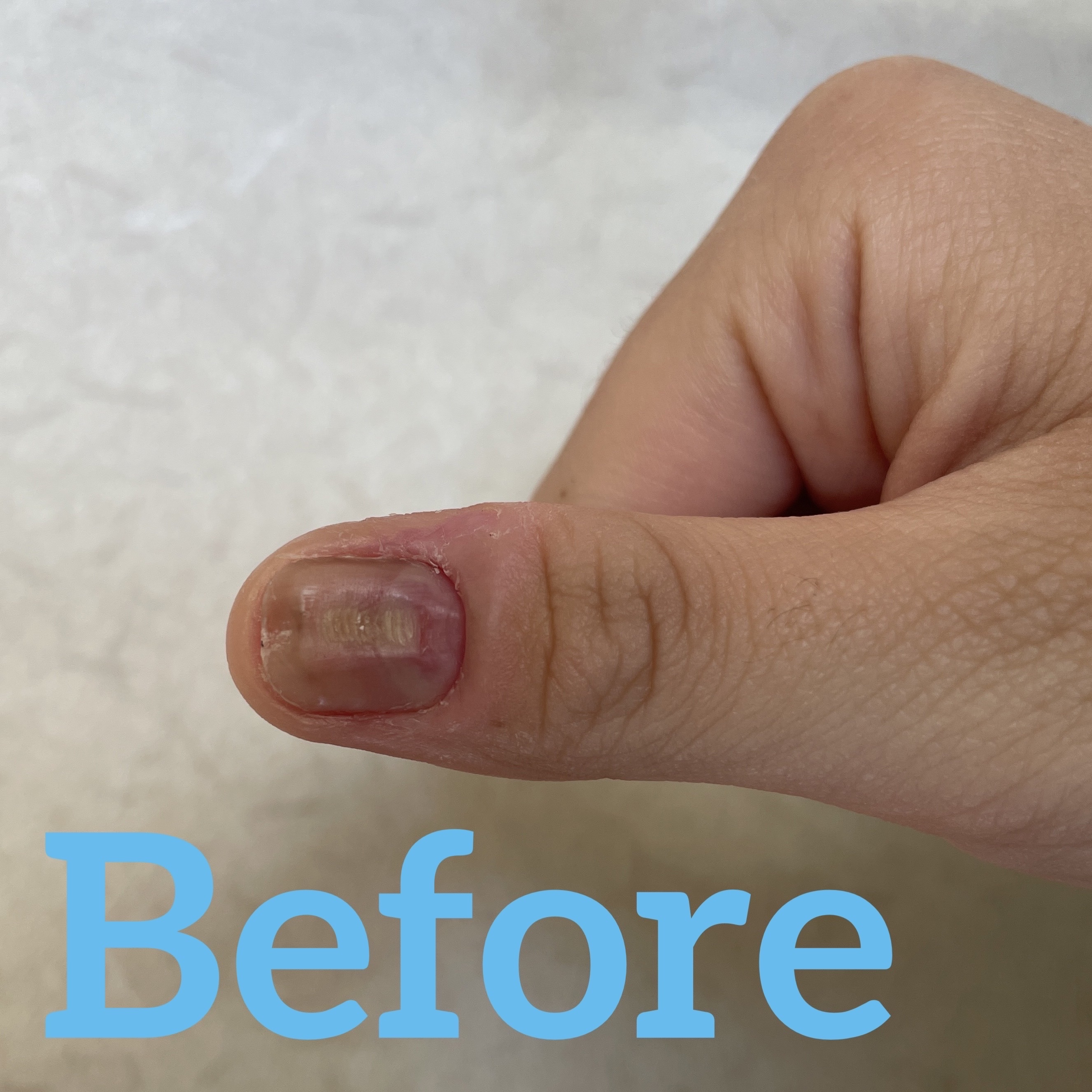 ディープセラム/Dr.Nail/ネイルオイル・トリートメントを使ったクチコミ（1枚目）