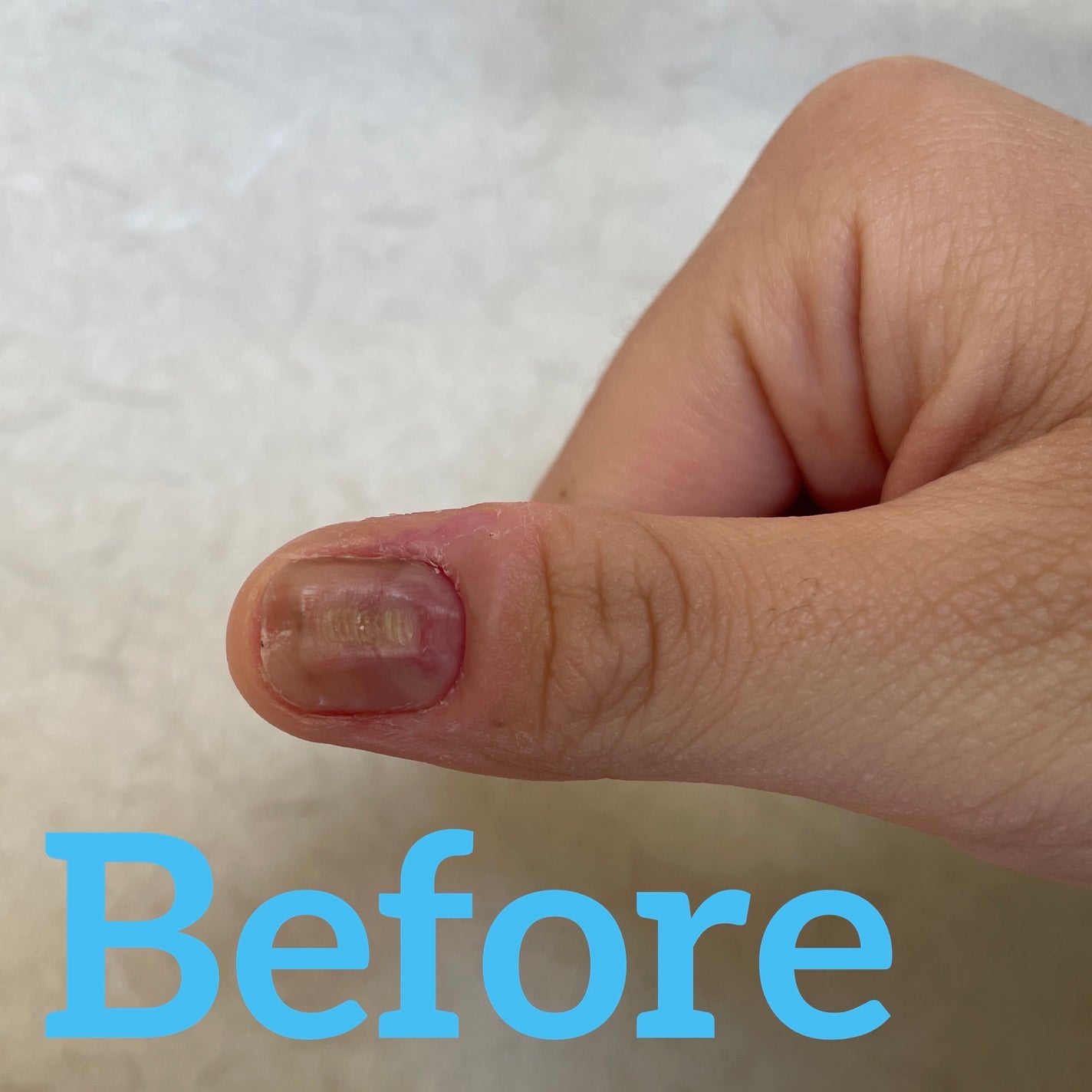 ディープセラム/Dr.Nail/ネイルオイル・トリートメントを使ったクチコミ(1枚目)